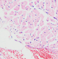 苏木素伊红混合染色液 Hematoxylin-Eosin (HE) Stain Solution